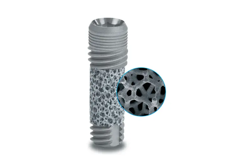 Zimmer Biomet Trabecular Metal implant sistemi yüzey ve trabeküler yapısı